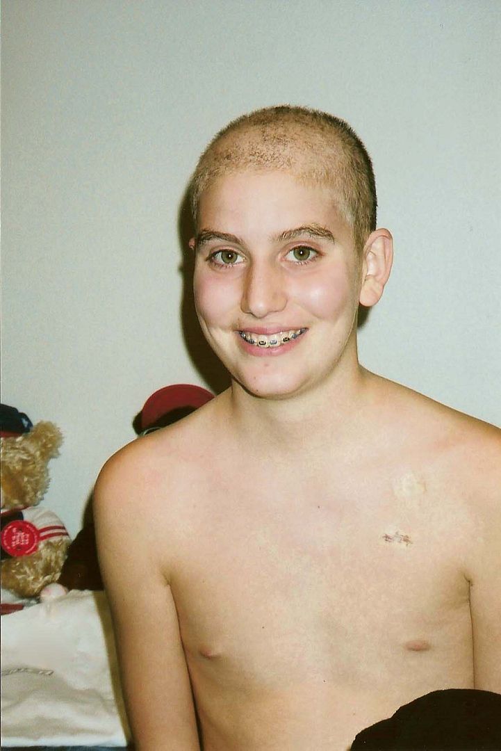 hair photo:hair loss product review 